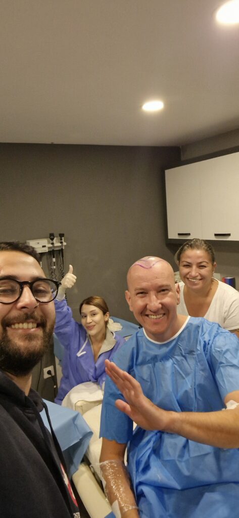 Micro fue Turkey | Hair Transplant gallery photo