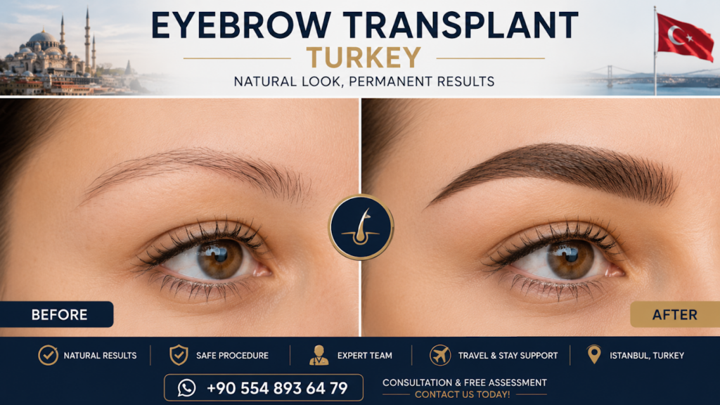 Micro fue Turkey | Hair Transplant gallery photo