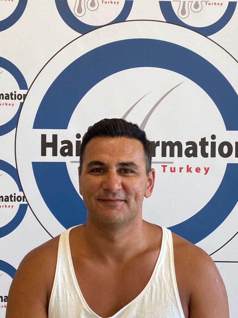 Hair Information Clinic – Saç Ekimi gallery photo