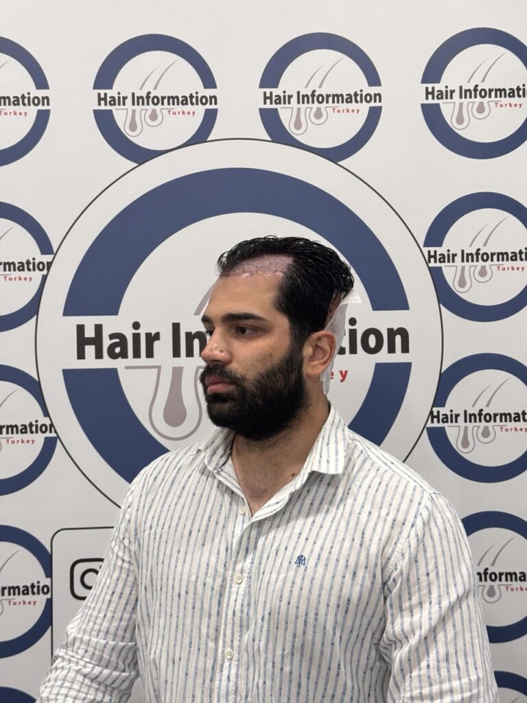 Hair Information Clinic – Saç Ekimi gallery photo