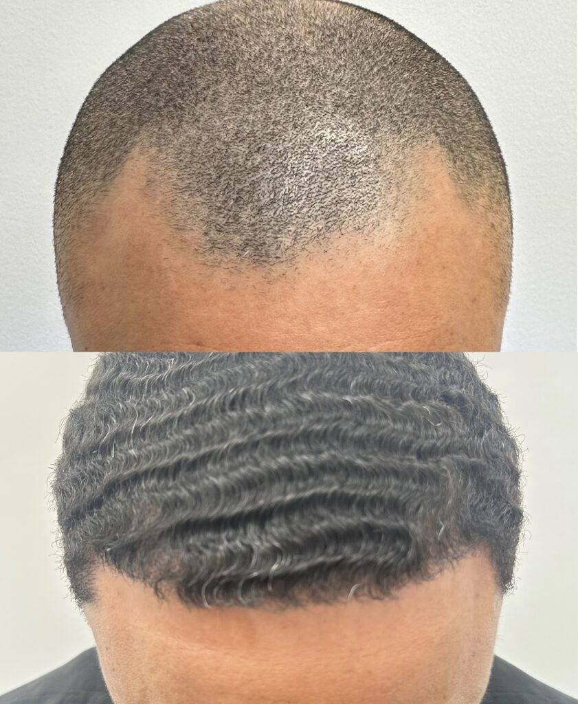 Crown Hair Institute — clinic photo from Google Maps