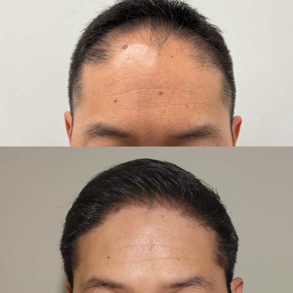Crown Hair Institute gallery photo
