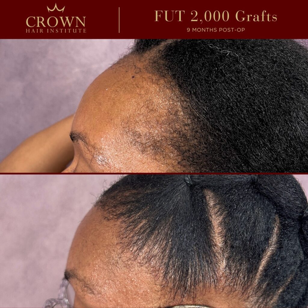 Crown Hair Institute gallery photo