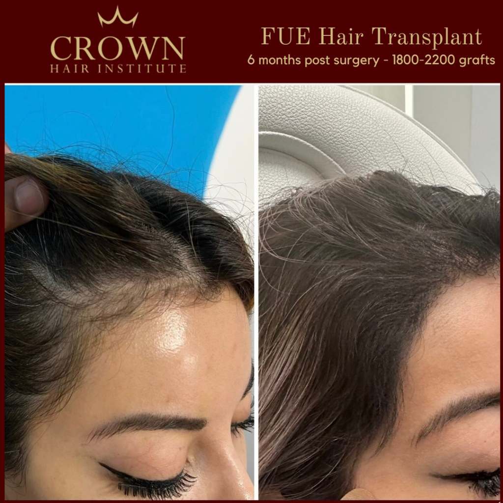 Crown Hair Institute gallery photo