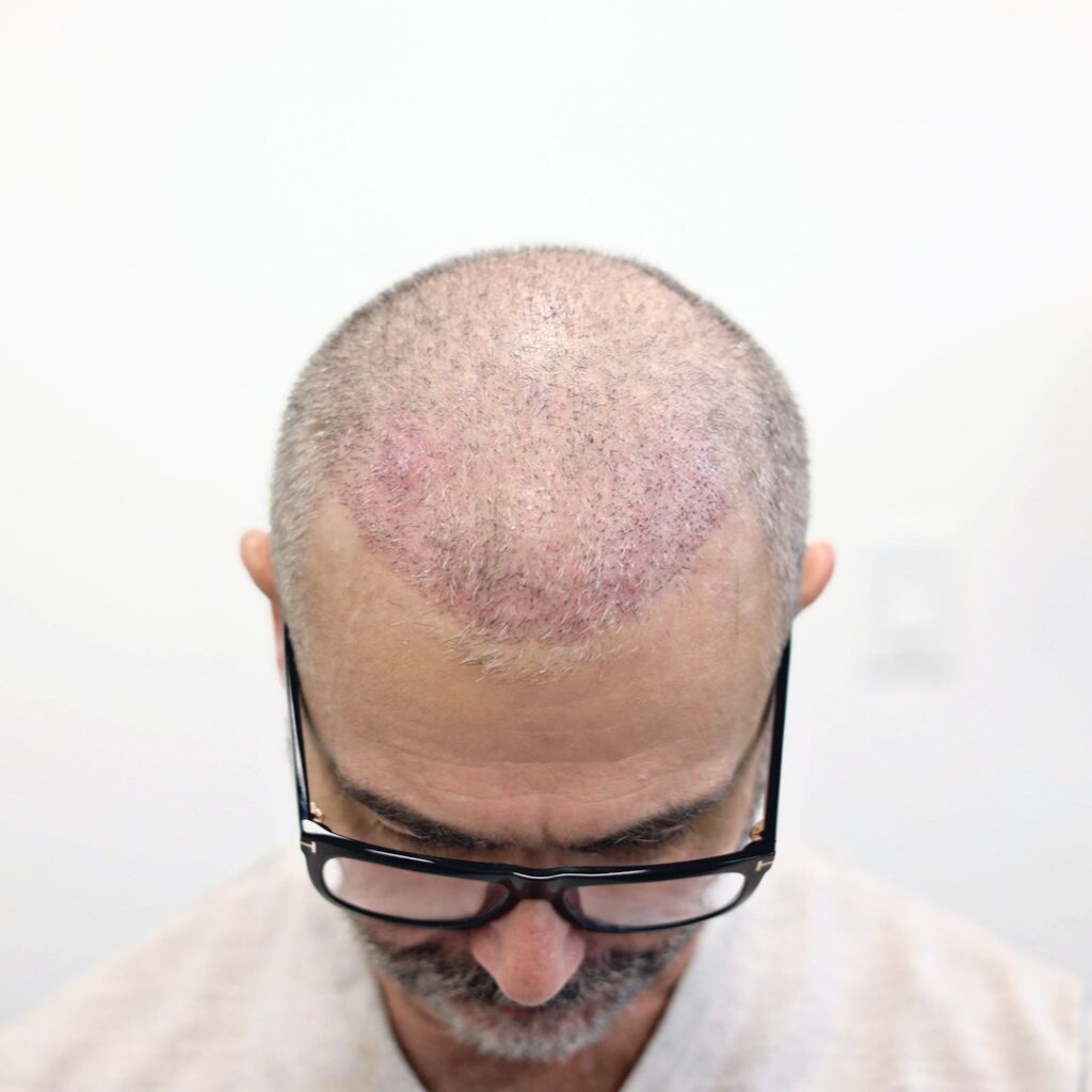 Dr. Hair of Chicago gallery photo