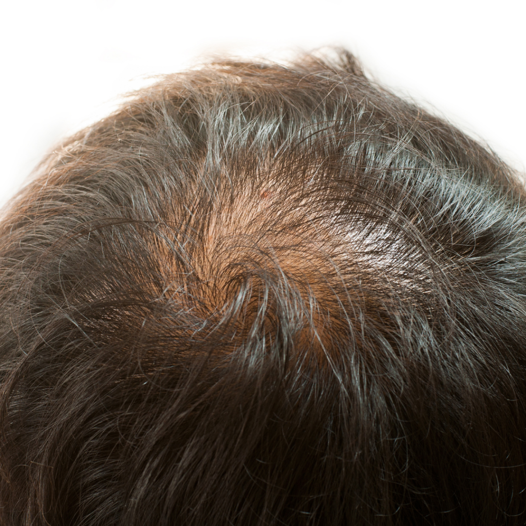 Ambroise Hair Institute gallery photo