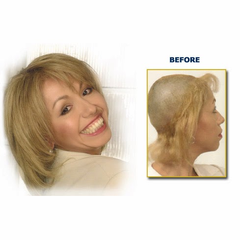 Raveen Hair Replacement gallery photo