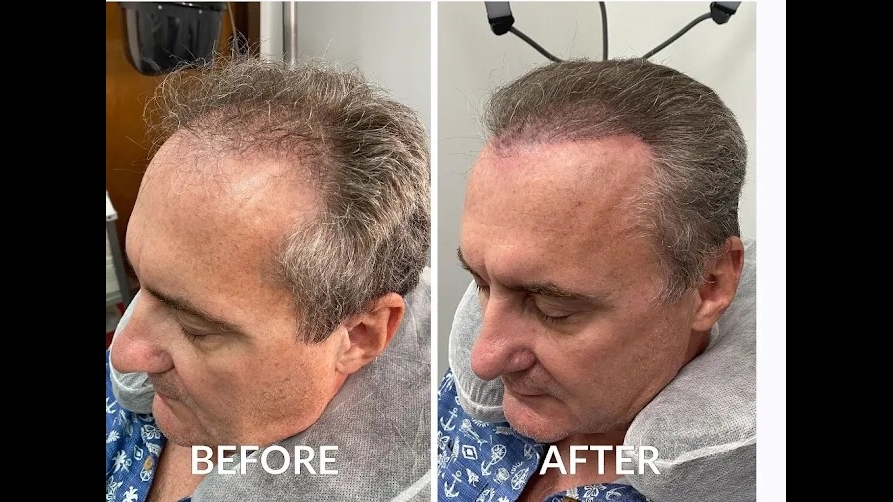 Texas Hair Restoration and Wellness Center gallery photo