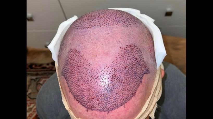 Best Hair Transplants Los Angeles — clinic photo from Google Maps