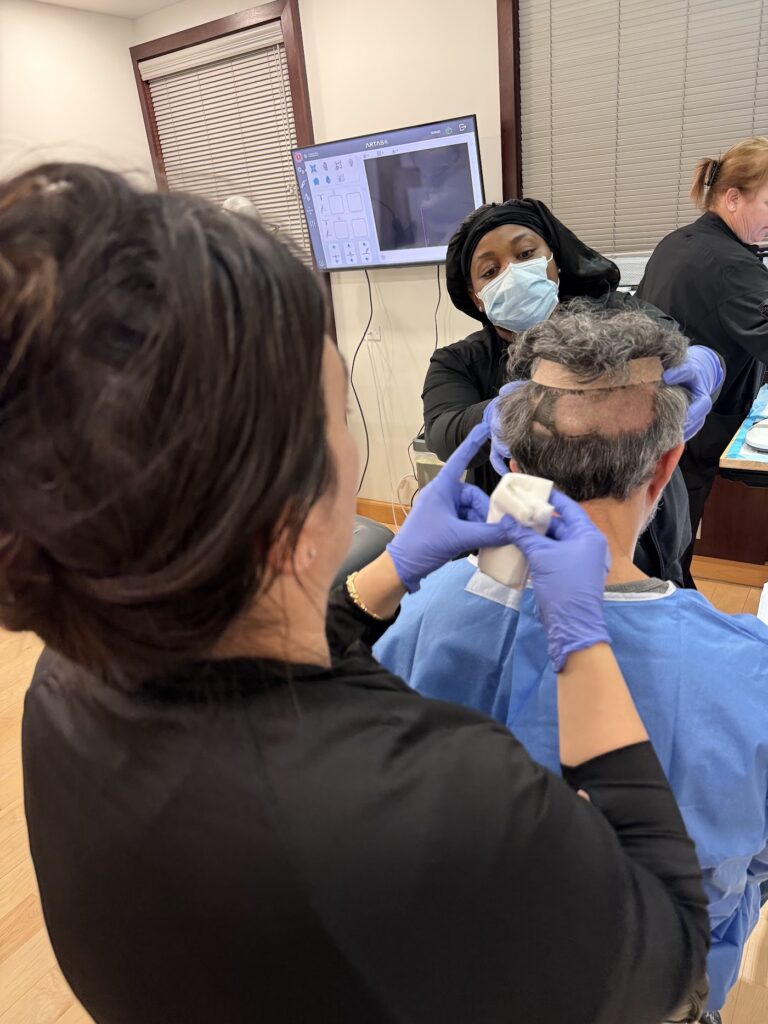 New York Hair Transplant gallery photo