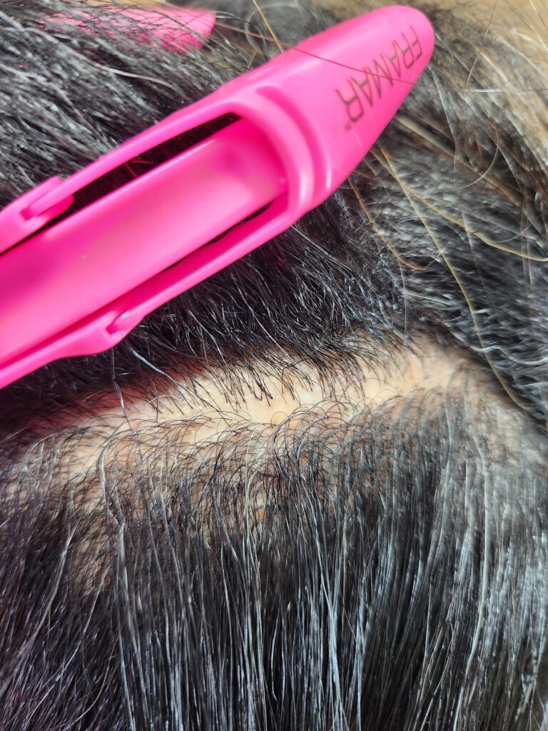 Beyond Your Hair Trichology Spa gallery photo