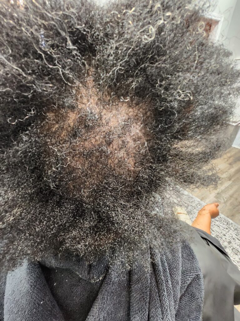 Beyond Your Hair Trichology Spa gallery photo