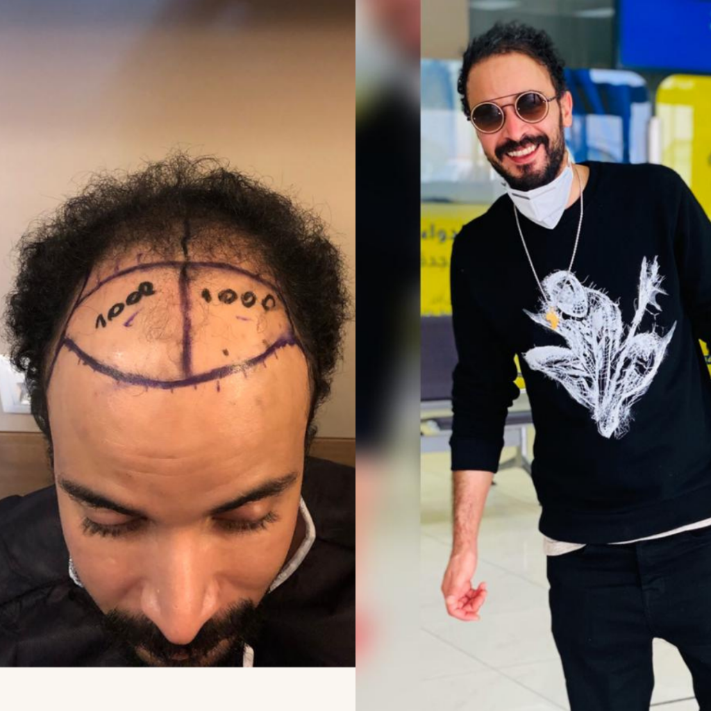 Maxim Hair Restoration & Transplants – Philadelphia gallery photo