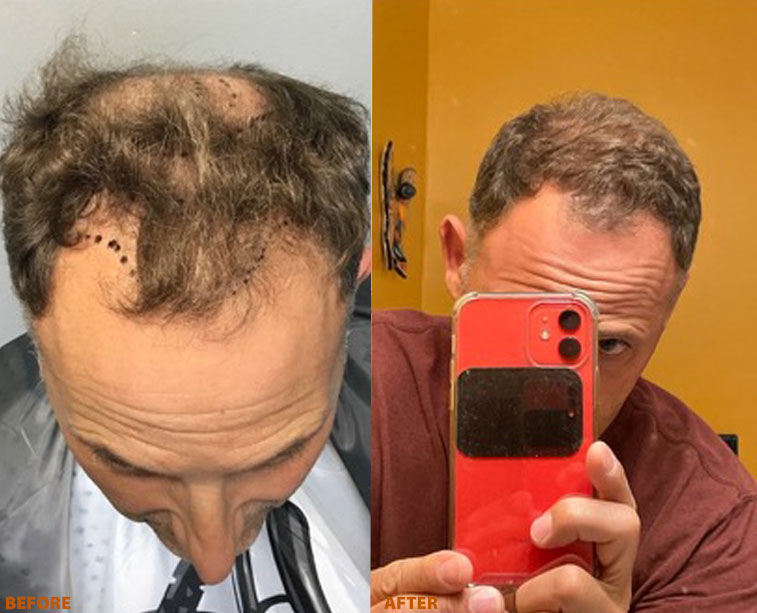Honest Hair Restoration gallery photo