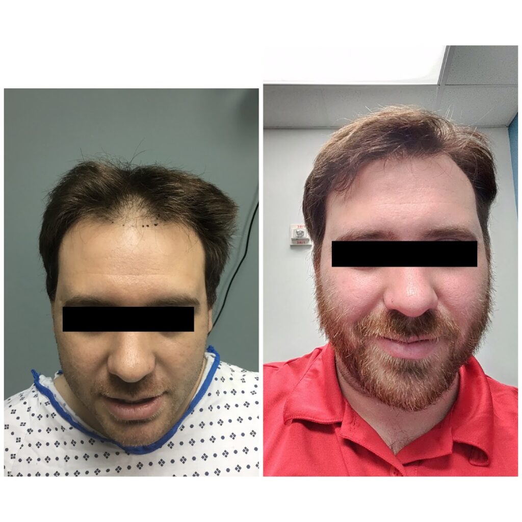 Honest Hair Restoration gallery photo