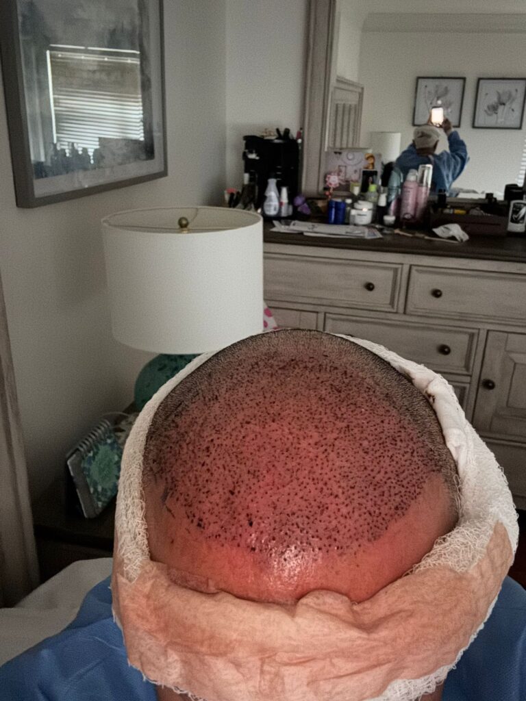 Mane Center for Hair Restoration gallery photo