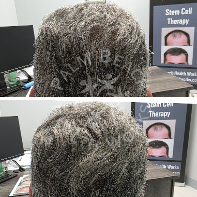 Palm Beach HealthWorks – Hair Replacement | Joint Pain Therapy | Wellness & Weight Loss | TRT Therapy gallery photo