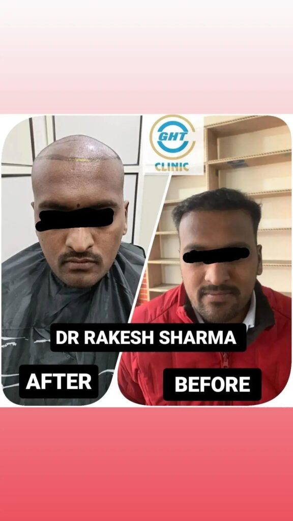 Gurgaon Hair Transplant Centre gallery photo