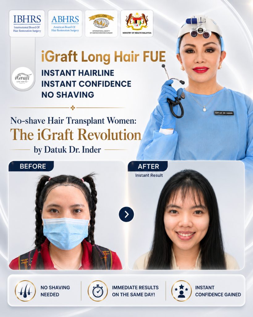 iGraft Long Hair FUE gallery photo