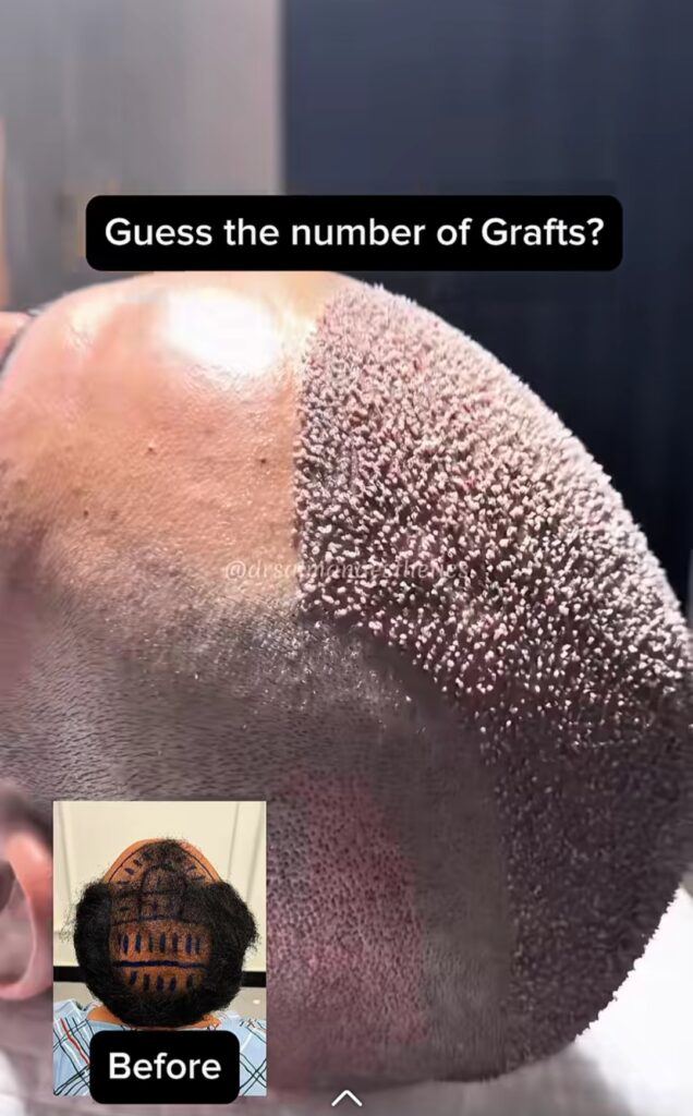 Glamorous Hair Transplant in Islamabad | Hair Surgeon’s – FUE Hair Transplant Islamabad, FUT Transplant, BioFibre, PRF — clinic photo from Google Maps