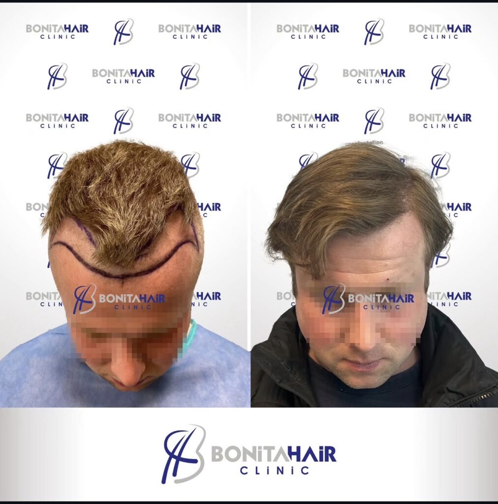Bonita Hair Clinic Capetown gallery photo