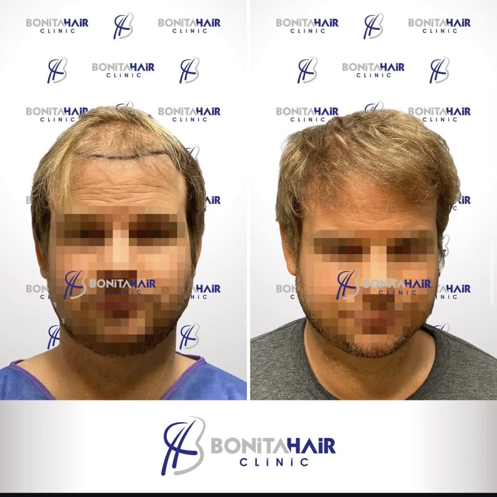 Bonita Hair Clinic Capetown gallery photo