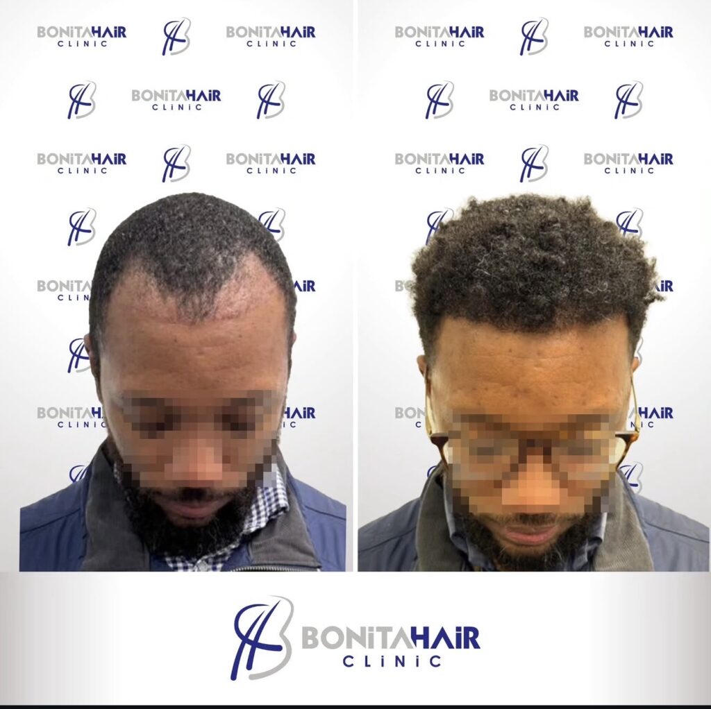 Bonita Hair Clinic Capetown gallery photo