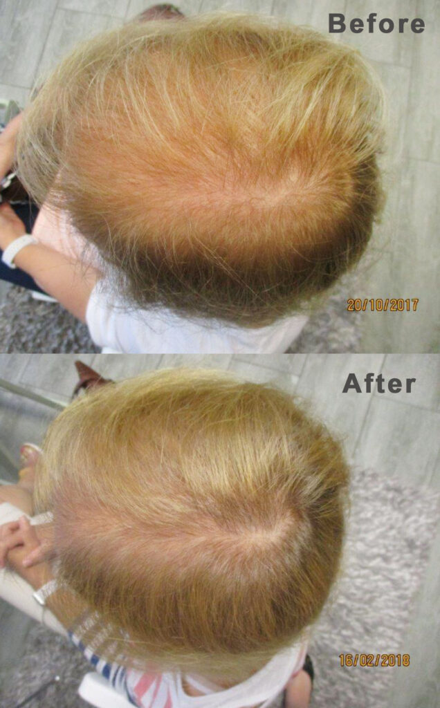 Hair Clinic International Umhlanga gallery photo