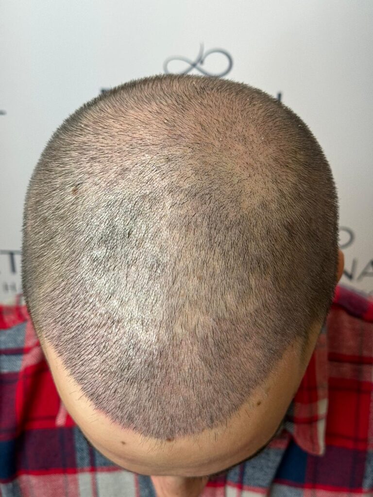 Eternal Hair Clinic gallery photo