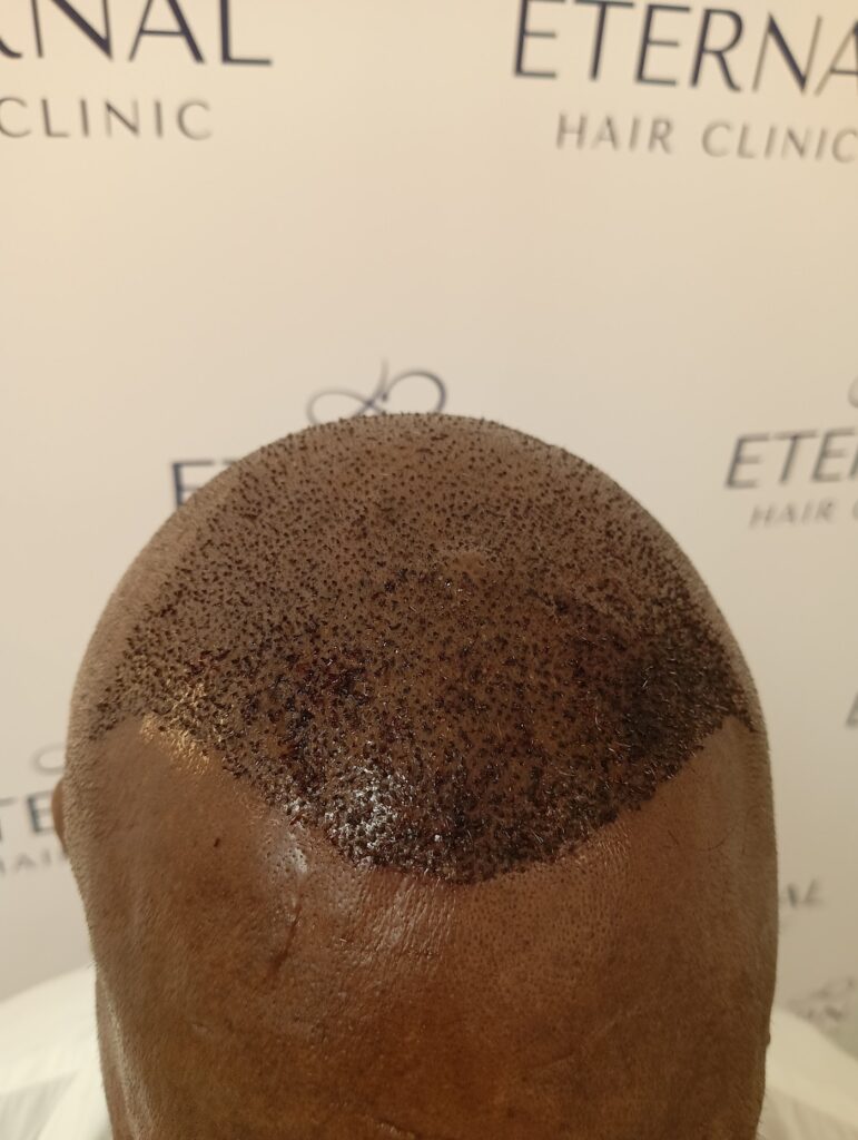 Eternal Hair Clinic gallery photo
