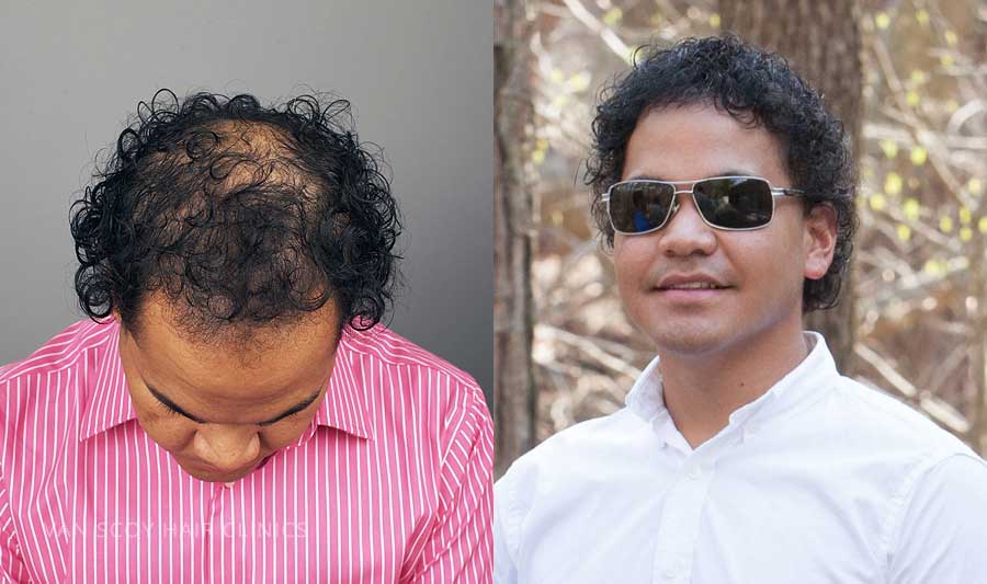 Van Scoy Hair Clinic – Columbus gallery photo