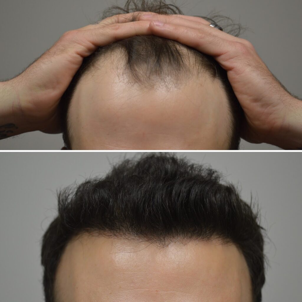 LA FUE Hair New York gallery photo