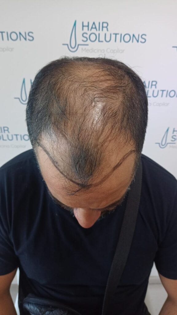 Hair Solutions gallery photo