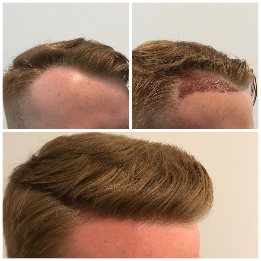 ANAGEN Clinic | Hair Transplant Doctor Melbourne gallery photo