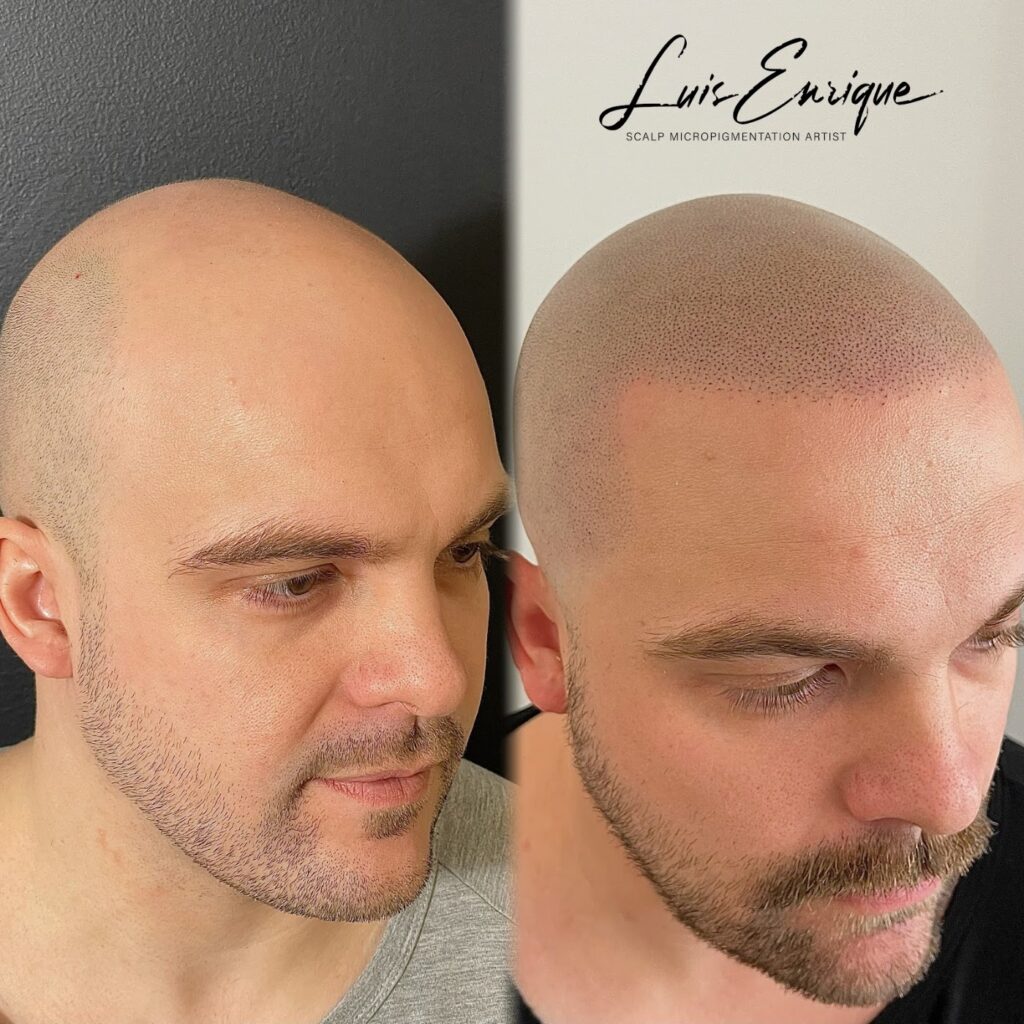 SMP Vancouver – Hair Tattoo Inc. | SMP By Luis Enrique gallery photo