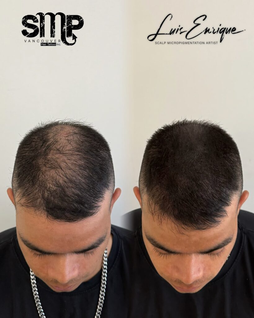 SMP Vancouver – Hair Tattoo Inc. | SMP By Luis Enrique gallery photo