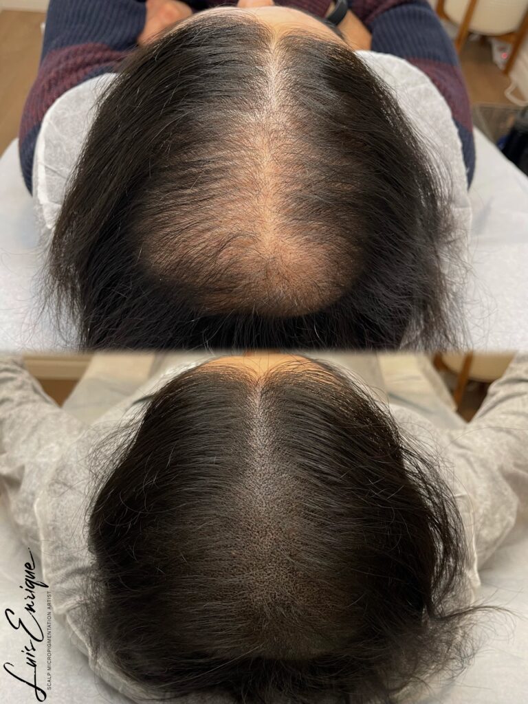 SMP Vancouver – Hair Tattoo Inc. | SMP By Luis Enrique gallery photo