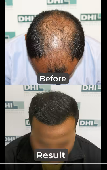 DHI India gallery photo