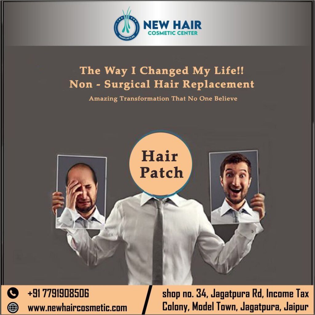 New hair cosmetic centre Best hair transplant, Best hair patch, gfc, prp, hair wigs in Jaipur gallery photo