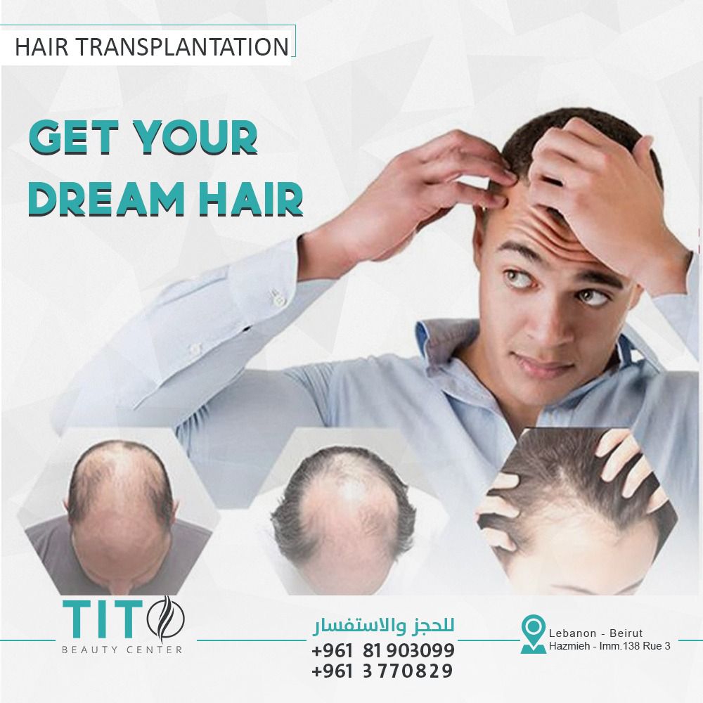 Hair transplant tito center gallery photo