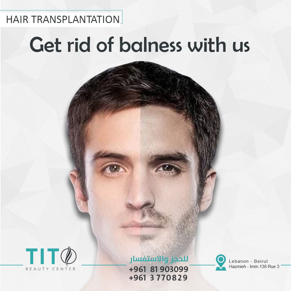 Hair transplant tito center gallery photo