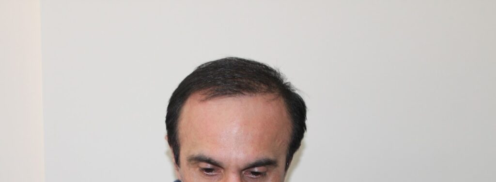 Transplant de păr – Hair transplant Bucuresti gallery photo