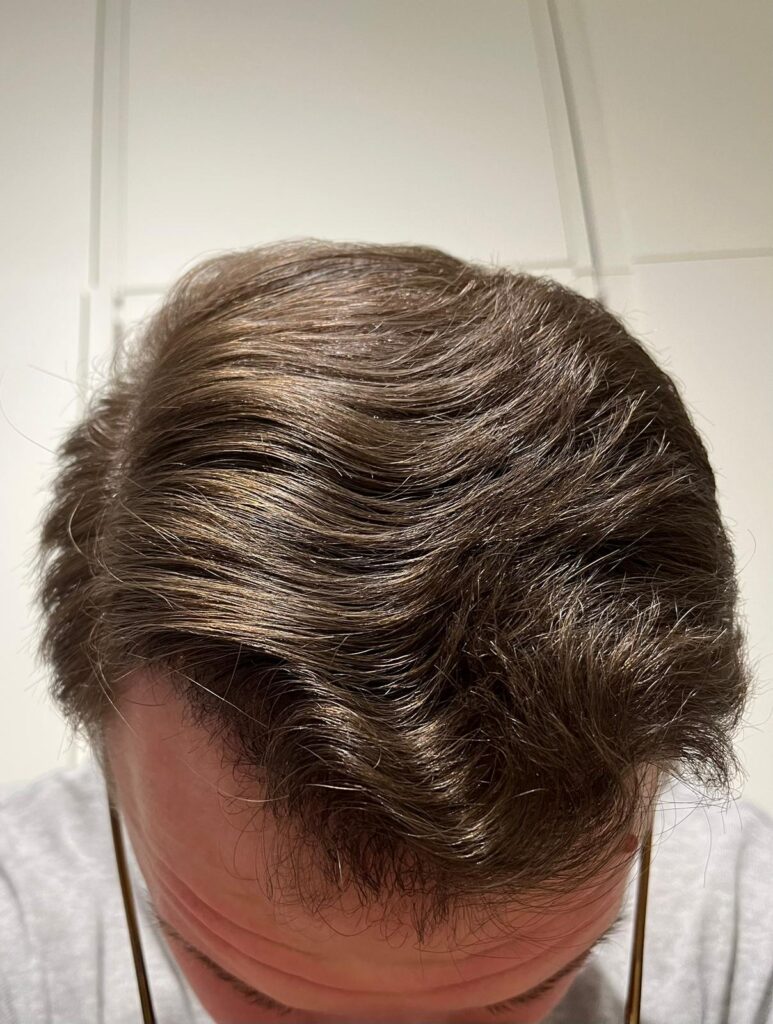 Erna Hair Clinic İzmir Saç Ekim Merkezi gallery photo