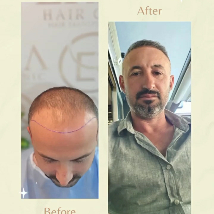 Erna Hair Clinic İzmir Saç Ekim Merkezi gallery photo