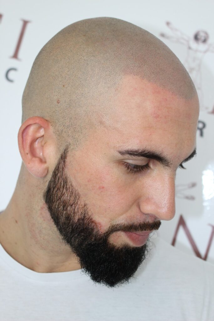 Vinci Hair Clinic gallery photo