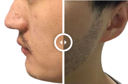 Hair Restoration Center gallery photo