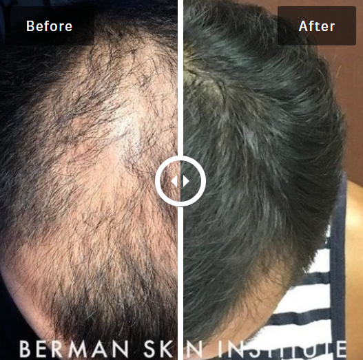 Hair Restoration Center gallery photo