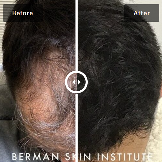 Hair Restoration Center gallery photo