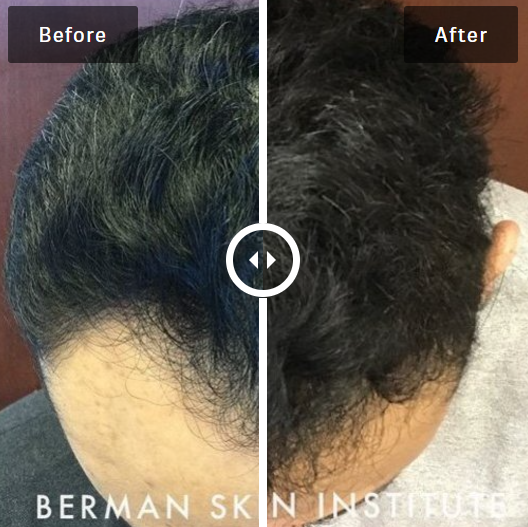 Hair Restoration Center gallery photo