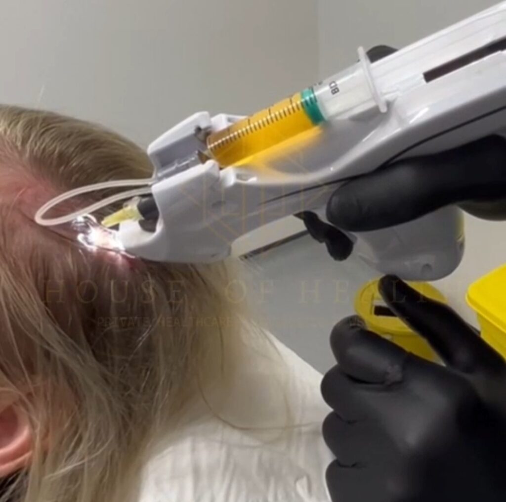 Dr Hair loss | Doctor-led Hair loss services gallery photo